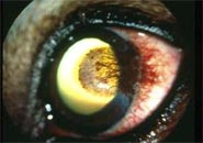 Ophthalmology